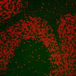 Nucleolin/NCL Antibody in Immunohistochemistry (Paraffin) (IHC (P))