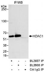 HDAC1 Antibody in Immunoprecipitation (IP)