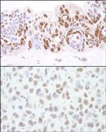 HDAC1 Antibody in Immunohistochemistry (Paraffin) (IHC (P))