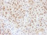 RNF20 Antibody in Immunohistochemistry (Paraffin) (IHC (P))