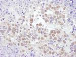 RNF20 Antibody in Immunohistochemistry (Paraffin) (IHC (P))