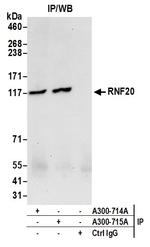 RNF20 Antibody in Immunoprecipitation (IP)