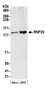 RNF20 Antibody in Western Blot (WB)