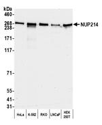 NUP214 Antibody in Western Blot (WB)