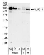 NUP214 Antibody in Western Blot (WB)