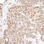 PRMT1 Antibody in Immunohistochemistry (Paraffin) (IHC (P))