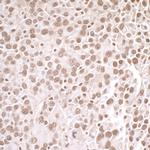 PRMT1 Antibody in Immunohistochemistry (Paraffin) (IHC (P))