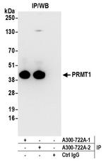 PRMT1 Antibody in Immunoprecipitation (IP)