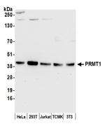 PRMT1 Antibody in Western Blot (WB)