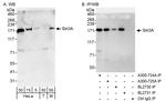 Sin3A Antibody in Western Blot (WB)