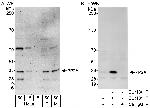 PP2A Antibody in Western Blot (WB)