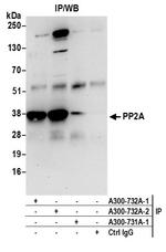 PP2A Antibody in Immunoprecipitation (IP)