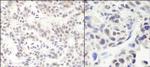 HMG2a Antibody in Immunohistochemistry (Paraffin) (IHC (P))