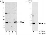 HMG2a Antibody in Western Blot (WB)