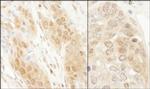 DJ-1 Antibody in Immunohistochemistry (Paraffin) (IHC (P))