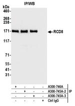 RCD8 Antibody in Immunoprecipitation (IP)