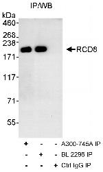 RCD8 Antibody in Immunoprecipitation (IP)