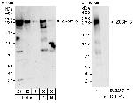 ZC3H13 Antibody in Western Blot (WB)