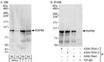 RAP80 Antibody in Western Blot (WB)