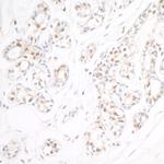 RAP80 Antibody in Immunohistochemistry (Paraffin) (IHC (P))