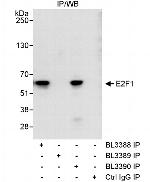 E2F1 Antibody in Immunoprecipitation (IP)