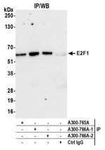 E2F1 Antibody in Immunoprecipitation (IP)