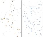 Phospho-KAP-1 (Ser824) Antibody in Immunocytochemistry (ICC/IF)