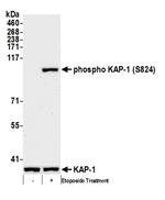 Phospho-KAP-1 (Ser824) Antibody in Western Blot (WB)