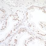 TORC1 Antibody in Immunohistochemistry (Paraffin) (IHC (P))