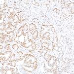 MED12 Antibody in Immunohistochemistry (Paraffin) (IHC (P))