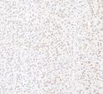 MED12 Antibody in Immunohistochemistry (Paraffin) (IHC (P))