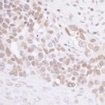 MIS12 Antibody in Immunohistochemistry (Paraffin) (IHC (P))