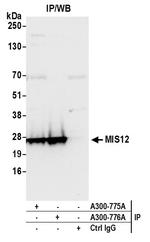 MIS12 Antibody in Immunoprecipitation (IP)