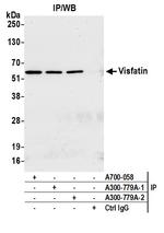 Visfatin Antibody in Immunoprecipitation (IP)