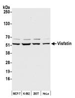 Visfatin Antibody in Western Blot (WB)