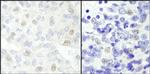 NCOA62 Antibody in Immunohistochemistry (Paraffin) (IHC (P))