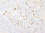 CDT1 Antibody in Immunohistochemistry (Paraffin) (IHC (P))