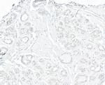 TRIP1/SUG1 Antibody in Immunohistochemistry (Paraffin) (IHC (P))