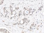 MED1 Antibody in Immunohistochemistry (Paraffin) (IHC (P))