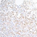 SUPT6H Antibody in Immunohistochemistry (Paraffin) (IHC (P))