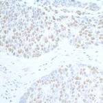 SUPT6H Antibody in Immunohistochemistry (Paraffin) (IHC (P))