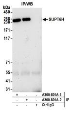 SUPT6H Antibody in Immunoprecipitation (IP)