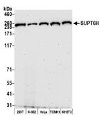 SUPT6H Antibody in Western Blot (WB)