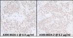 SUPT6H Antibody in Immunohistochemistry (Paraffin) (IHC (P))