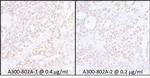 SUPT6H Antibody in Immunohistochemistry (Paraffin) (IHC (P))