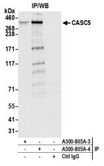 CASC5 Antibody in Immunoprecipitation (IP)