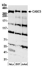 CASC5 Antibody in Western Blot (WB)