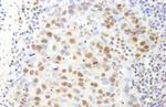 SAFB1 Antibody in Immunohistochemistry (Paraffin) (IHC (P))