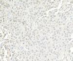 BRG1/SMARCA4 Antibody in Immunohistochemistry (Paraffin) (IHC (P))