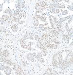 BRG1/SMARCA4 Antibody in Immunohistochemistry (Paraffin) (IHC (P))